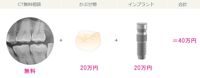 implantprice