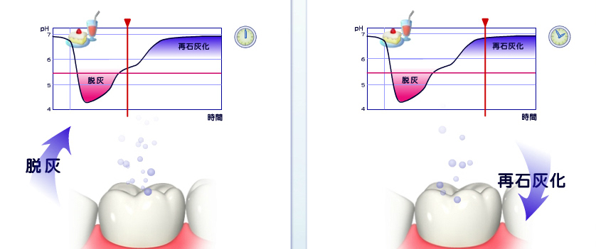 再石灰化