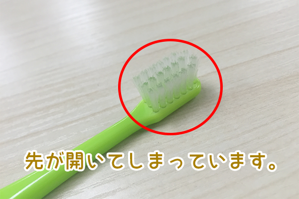 先が開いた歯ブラシ