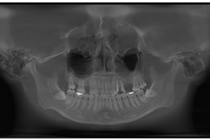 dental