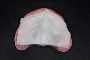 シートタイプ入れ歯安定剤使用方法