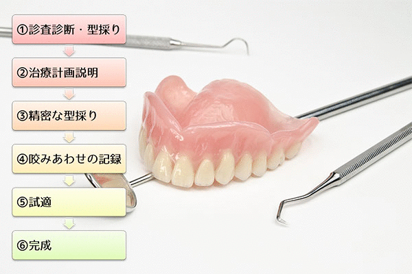 入れ歯が作られる手順