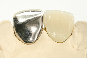 セラミックは金属を使用しないで製作する
