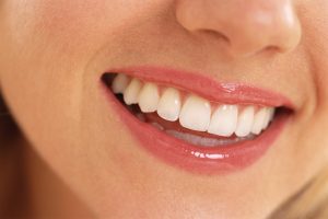 ホワイトニングを長持ちさせる方法