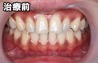 お客様の声:名無し様