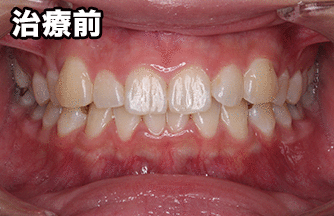 お客様の声:A.K様