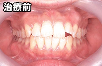 患者様の声:M.K様