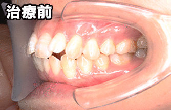 患者様の声:M.K様