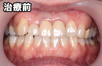 患者様の声:林様